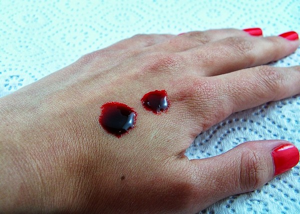 кровь на руке