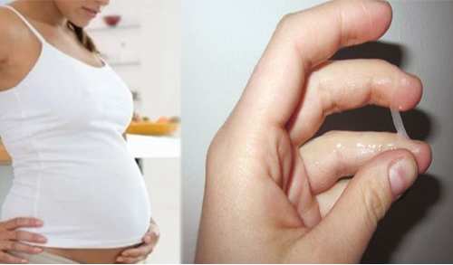 Белые выделения при беременности 