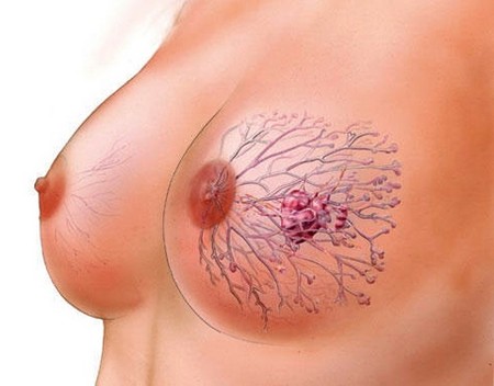 женская грудь 