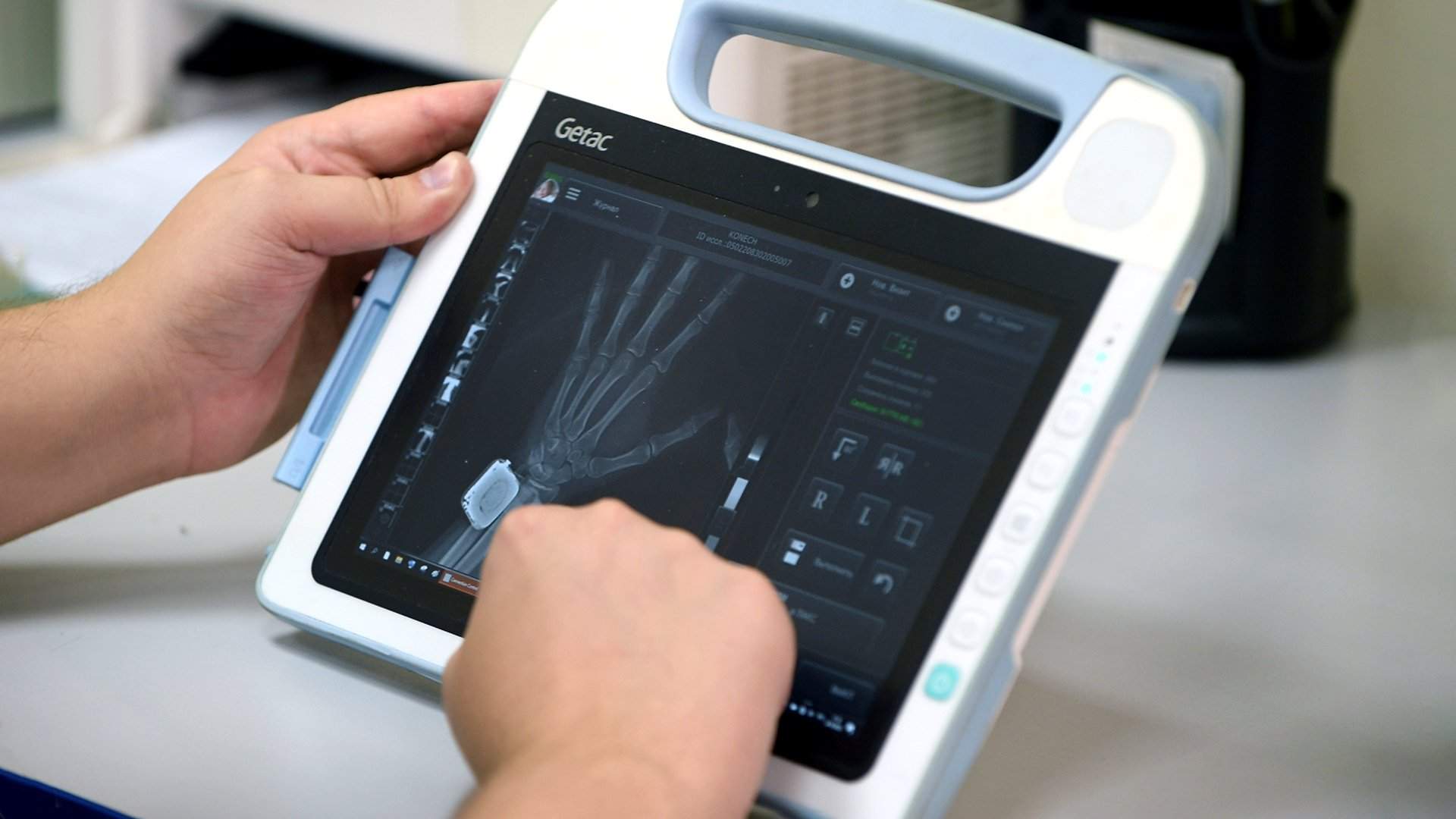 Рентгеновские цифровые аппараты: революция в медицинской диагностике