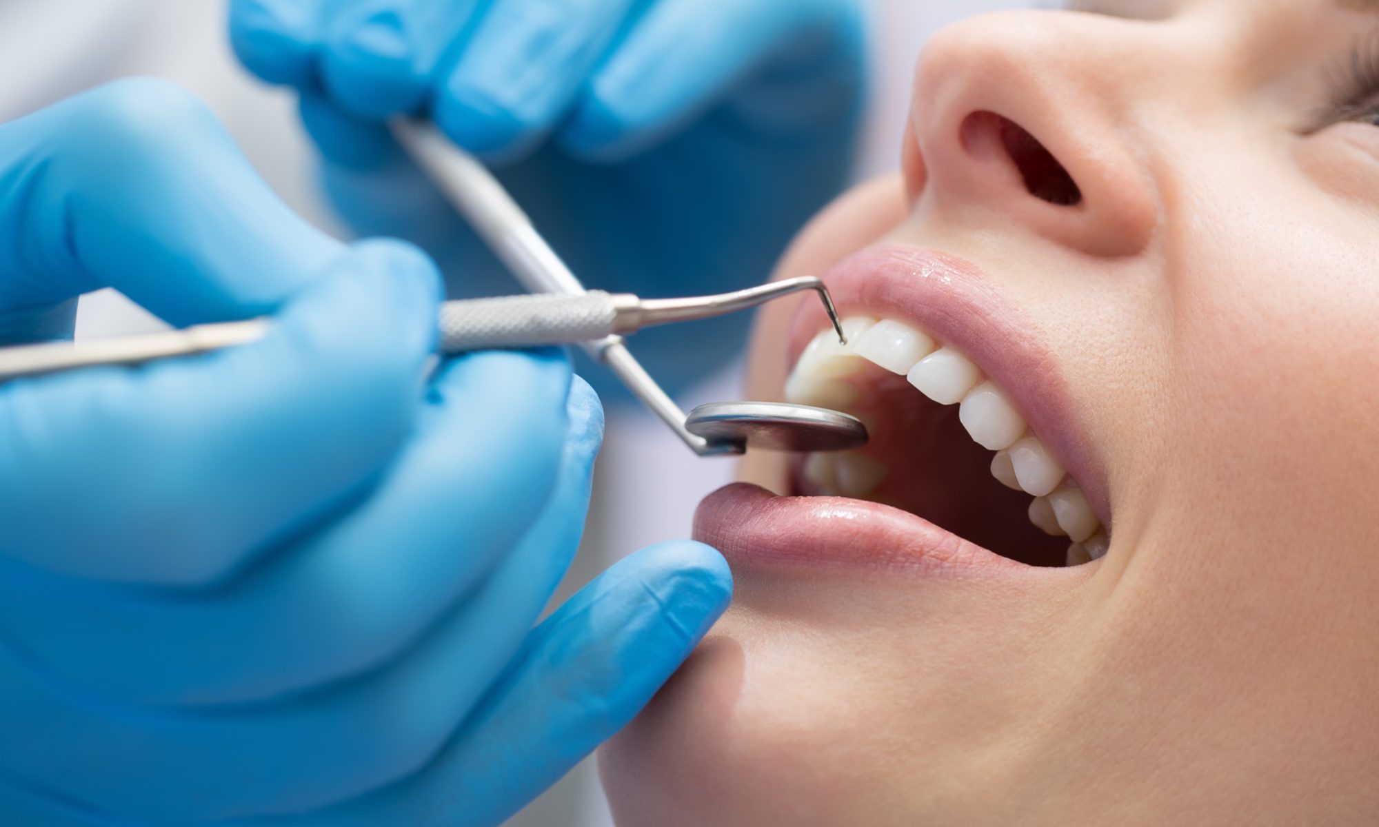 Лечение зубов: правила и советы для здоровой улыбки